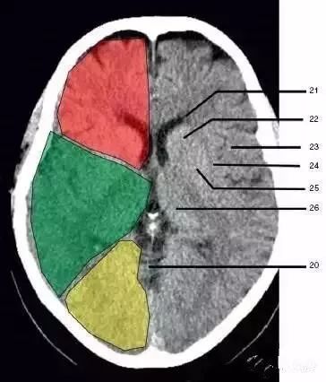 颅脑影像读片教程,颅脑影像读片怎么看