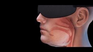 智能止鼾器治疗打鼾,智能止鼾神器防止打呼噜挂脖子