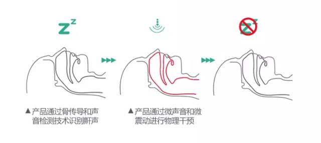 智能止鼾器治疗打鼾,智能止鼾神器防止打呼噜挂脖子