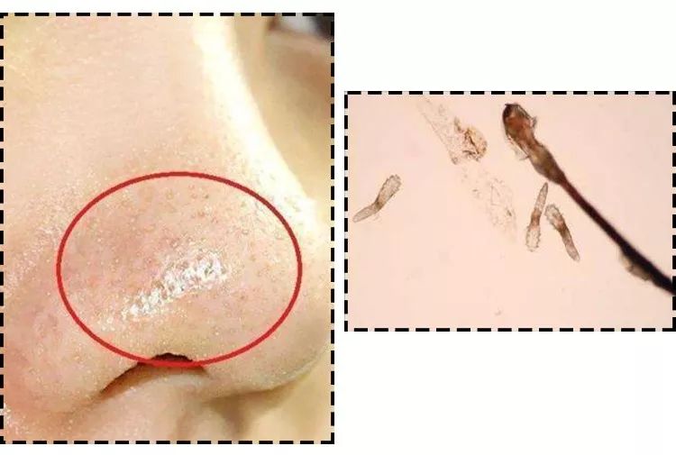 周冬雨17岁是什么样子,周冬雨17岁年轻时