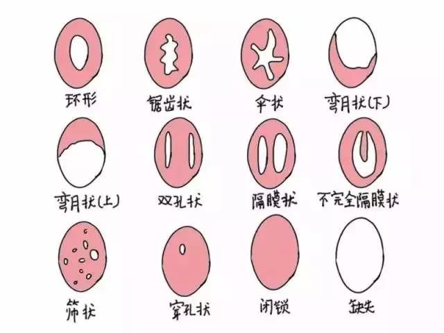 女生必知的10条妇科常识，最后一条特别重要！