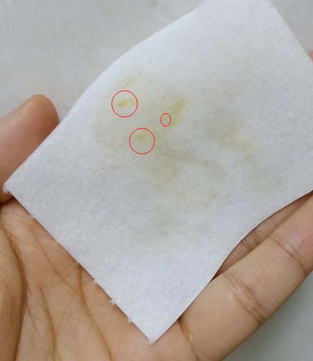 日本草莓鼻去黑头最有效的产品,byebye草莓鼻去黑头神器大揭秘