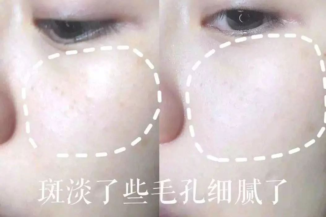 懒人美白黑科技,黑科技一秒变白的神器