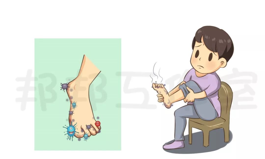 脚气引起的脚面溃烂肿胀怎么治愈,身上感染了脚气真菌要怎么治愈