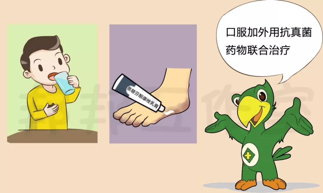 脚气引起的脚面溃烂肿胀怎么治愈,身上感染了脚气真菌要怎么治愈