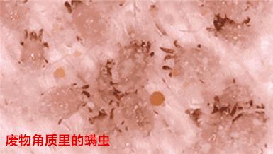 脸上搓出3斤泥！难怪又黄又暗又黑头！10秒给脸蛋“剥壳”，厉害