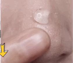 脸上搓出3斤泥！难怪又黄又暗又黑头！10秒给脸蛋“剥壳”，厉害