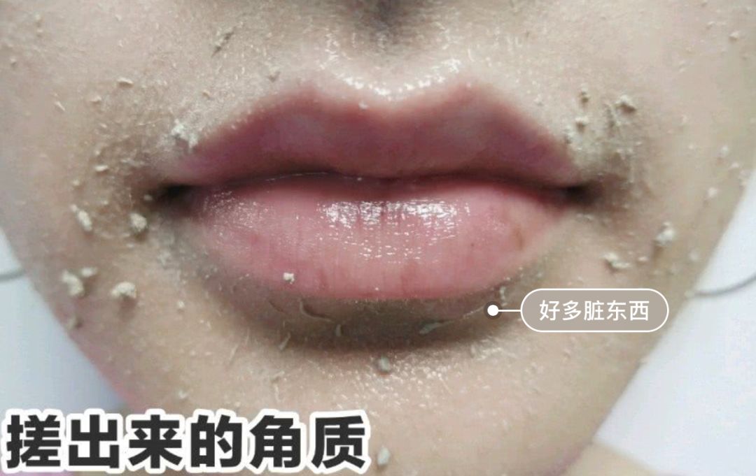 脸上搓出3斤泥！难怪又黄又暗又黑头！10秒给脸蛋“剥壳”，厉害