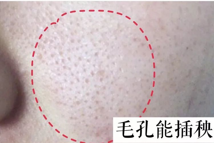 脸上搓出3斤泥！难怪又黄又暗又黑头！10秒给脸蛋“剥壳”，厉害