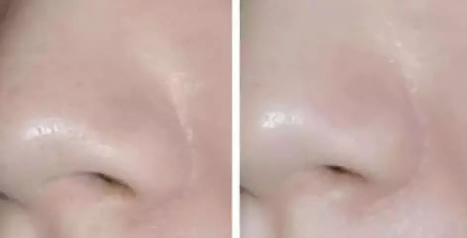 贴片式面膜推荐补水修复,口碑最好的贴片面膜