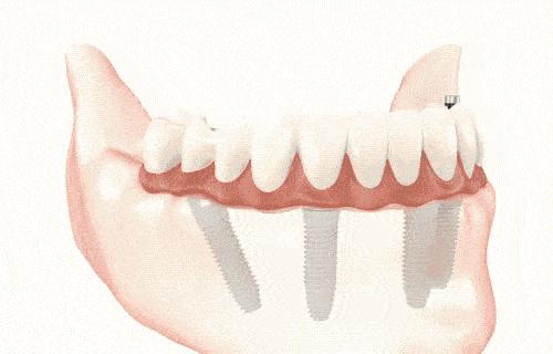 石家庄发放1000万汽车消费券,石家庄消费券发放时间表2021