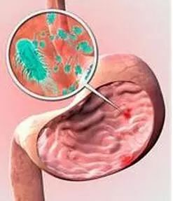 脾胃虚寒引起的口臭怎么调理,脾胃虚弱引起的口臭多久能改善