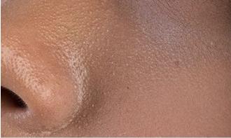 柔嫩抛光|脸上搓出3斤泥！难怪又黄又暗又黑头！10秒给脸蛋“剥壳”，厉害