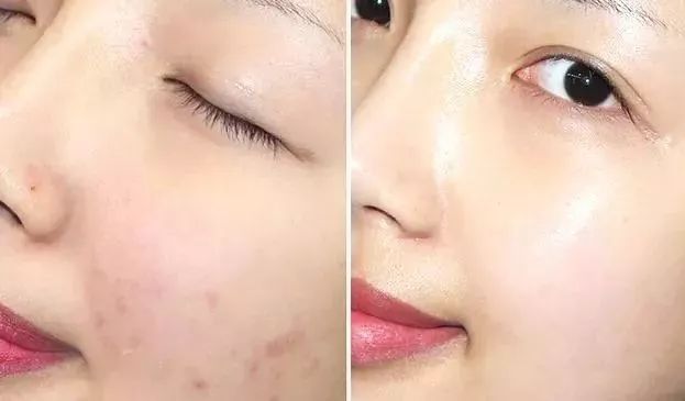 带有修护力且清爽不黏腻的精华,好用的新西兰精华液