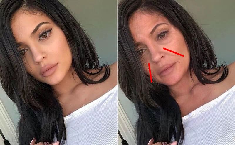 35岁了法令纹鱼尾纹眉间纹怎么办,三十岁就有眉间纹法令纹怎么办