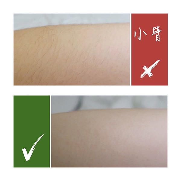 飞利浦脱毛仪详细全过程,猕猴桃家用脱毛仪