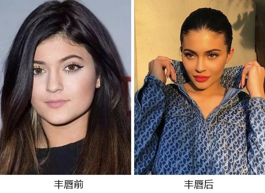 丰唇怎样让唇边更立体,适合丰唇的唇形