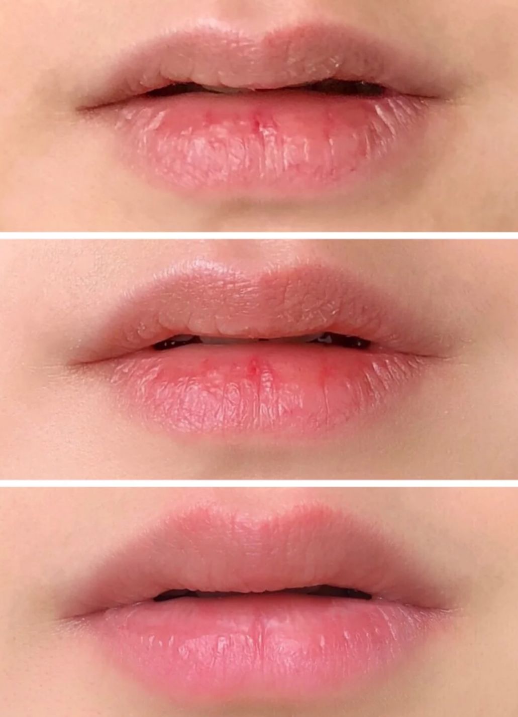 丰唇怎样让唇边更立体,适合丰唇的唇形
