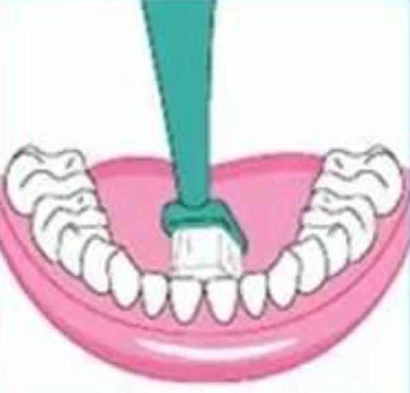 特别爱长牙石是怎么回事,长牙石是什么原因引起的