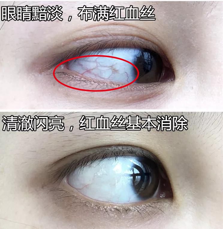 适合熬夜的护眼神器,眼睛疲劳用什么护眼神器