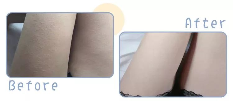 小个子女生要怎么穿衣服好看,小个子女生怎么穿1米7