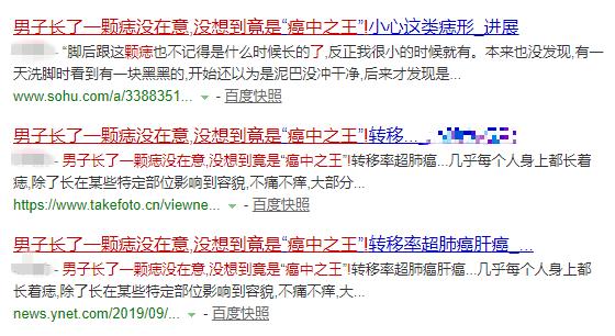 这样的痣可能变成癌中之王？把痣点掉能预防吗？