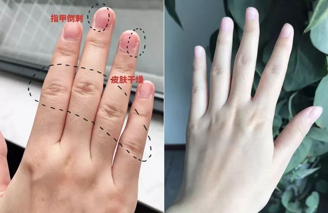 一天洗无数次手，记得要这么做