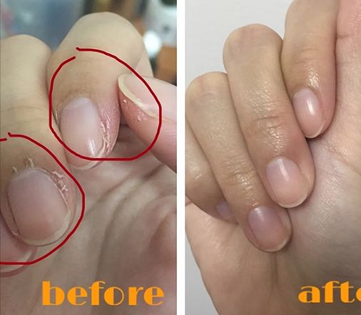 一天洗无数次手，记得要这么做