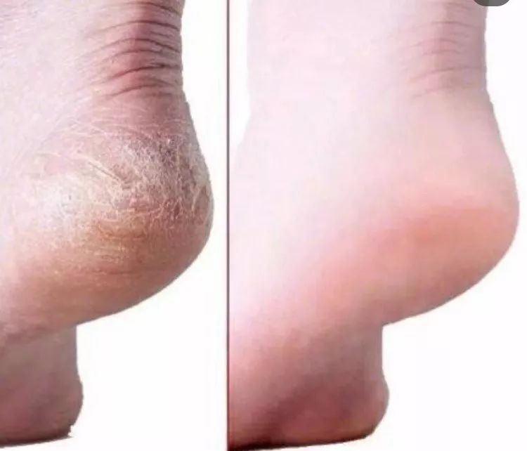 一天洗无数次手，记得要这么做