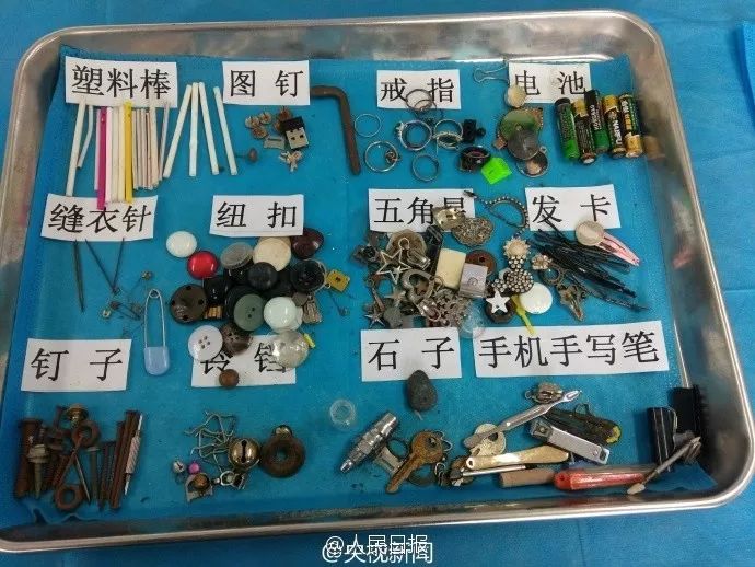 3岁女童患怪病肚子大如球,7岁女童突然腹痛元凶竟是畸胎瘤