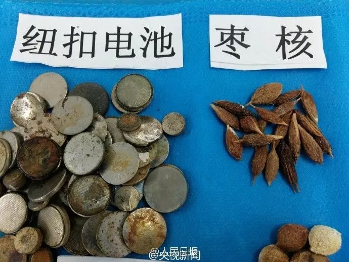 3岁女童患怪病肚子大如球,7岁女童突然腹痛元凶竟是畸胎瘤