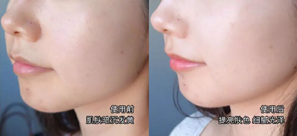 坚决不做“黄脸婆”！有了它，再差的皮肤都有救！丨开团