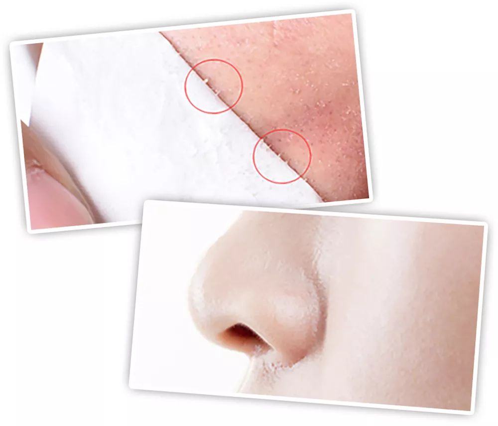 坚决不做“黄脸婆”！有了它，再差的皮肤都有救！丨开团