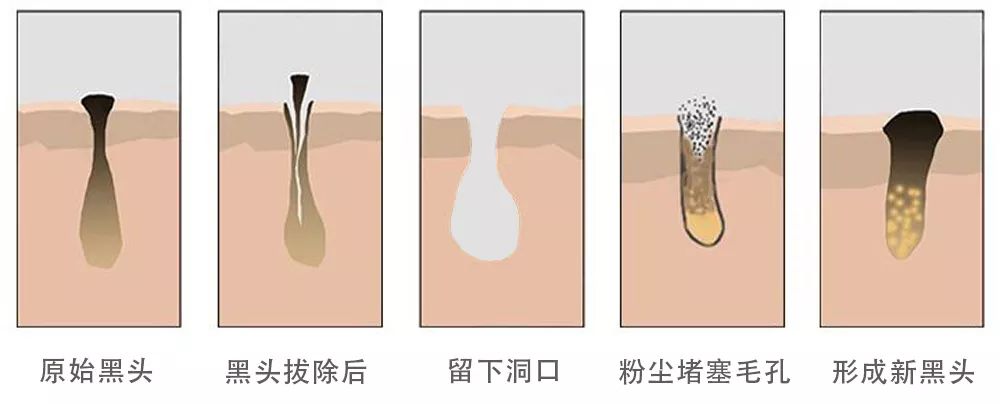 坚决不做“黄脸婆”！有了它，再差的皮肤都有救！丨开团