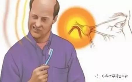 枕神经痛的症状和治疗方法,神经痛的原因及治疗方法