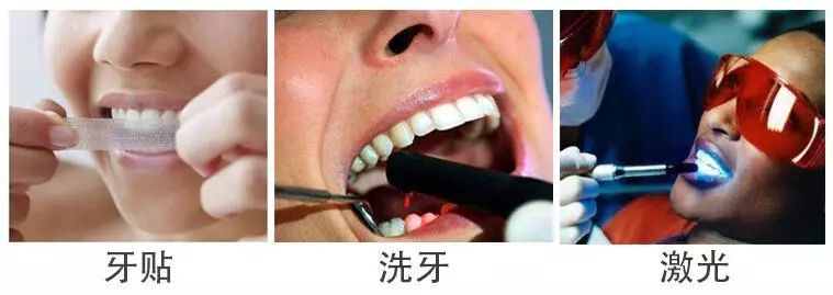 俄罗斯牙膏美白去口臭牙黄,去牙垢黄牙的牙膏测评