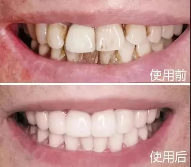 俄罗斯牙膏美白去口臭牙黄,去牙垢黄牙的牙膏测评