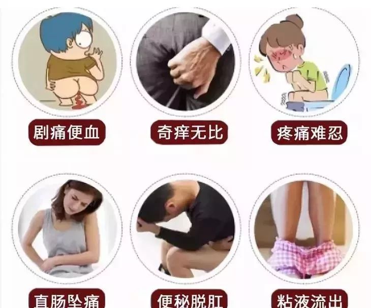 治痔疮最有效的痔疮膏,十多年的痔疮用痔疮膏效果怎么样