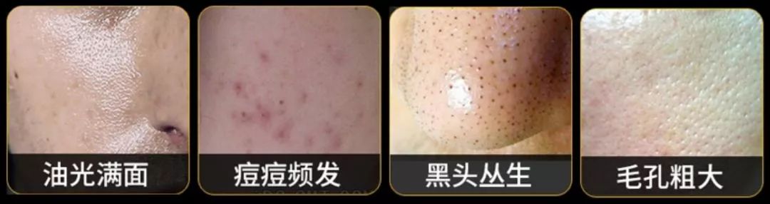 欧莱雅控油保湿女士洗面奶,欧莱雅控油炭爽洗面奶男女通用