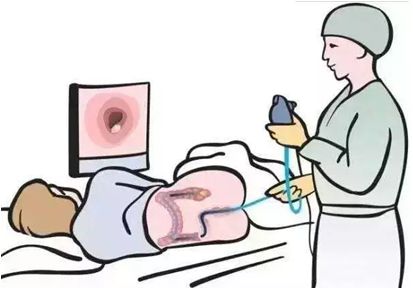 肠息肉为啥春风吹又生？