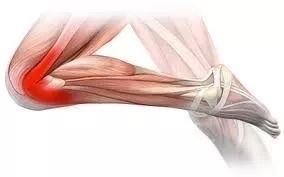 璺戞鑰呰啙,璺戞鑰呰啙鐤兼槸鎬庝箞鍥炰簨