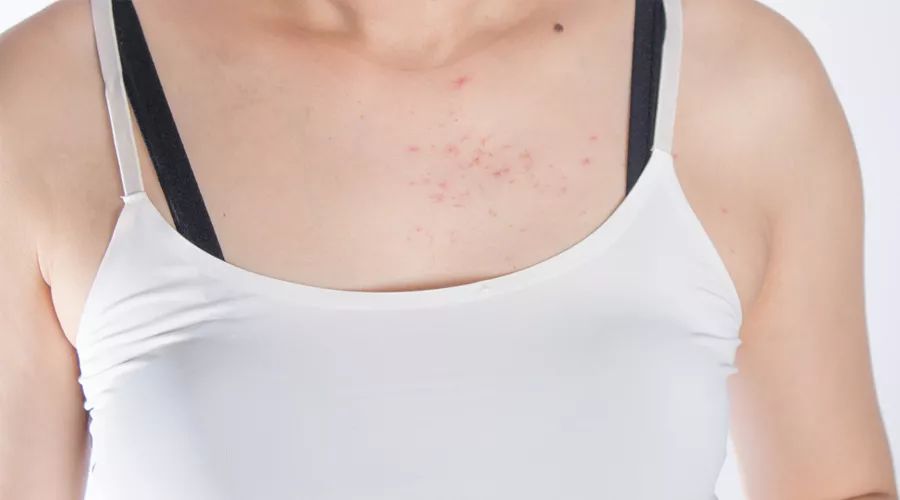 脱毛秋冬季是不是比较好,秋冬才是脱毛的最佳时间