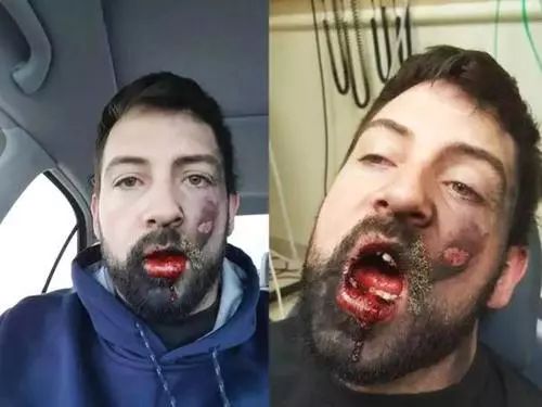 男子飞机上吸烟被拘,飞机吸烟男子被拘留