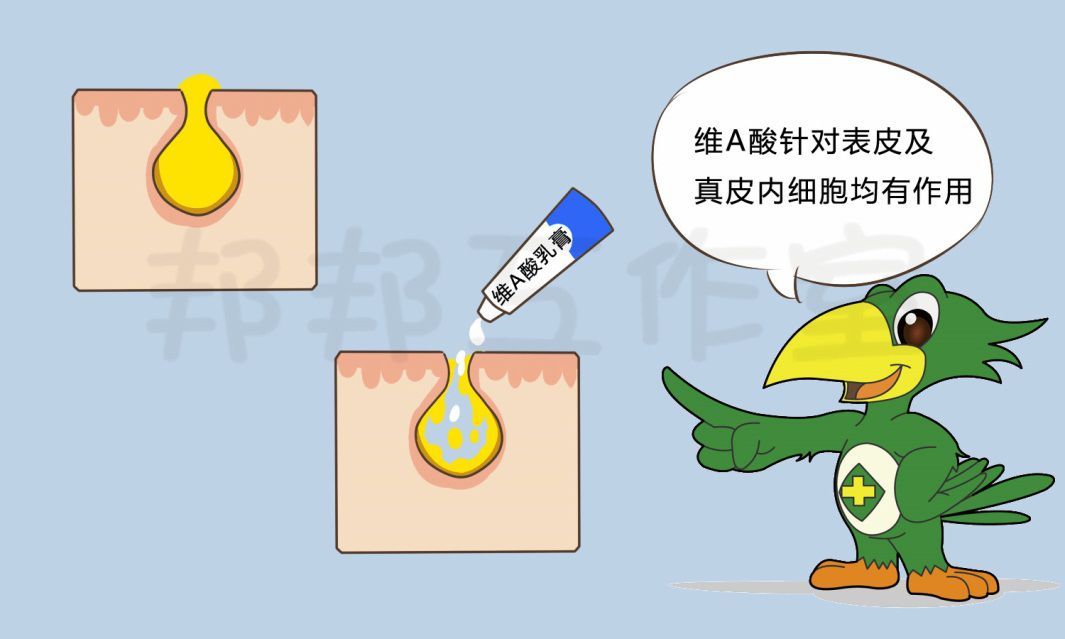 长黑头粉刺该怎么快速去除,鼻子上的黑头特别多该怎么去除