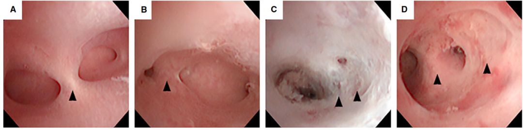 人流危害讲解视频3分钟,人流危害科普短片