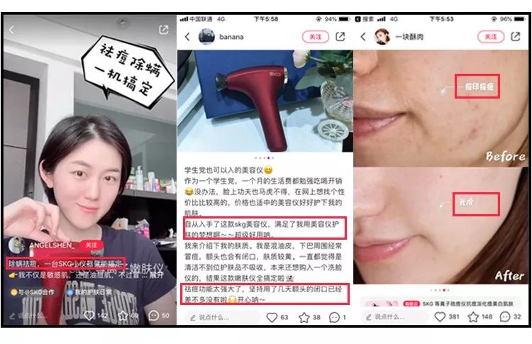 周冬雨17岁是什么样子,周冬雨17岁年轻时