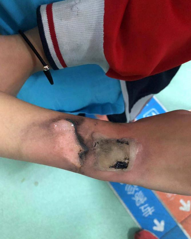 家长速看孩子有哪些小秘密,家长速自查这些文具很多孩子在用