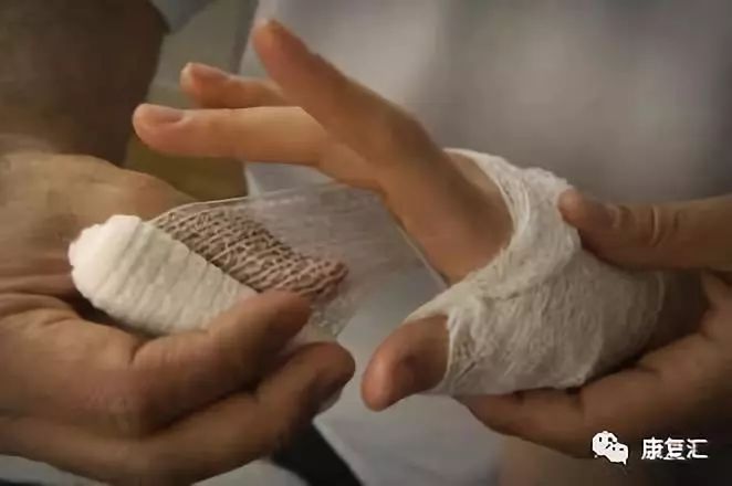 伤口健康科普短视频,伤口健康科普