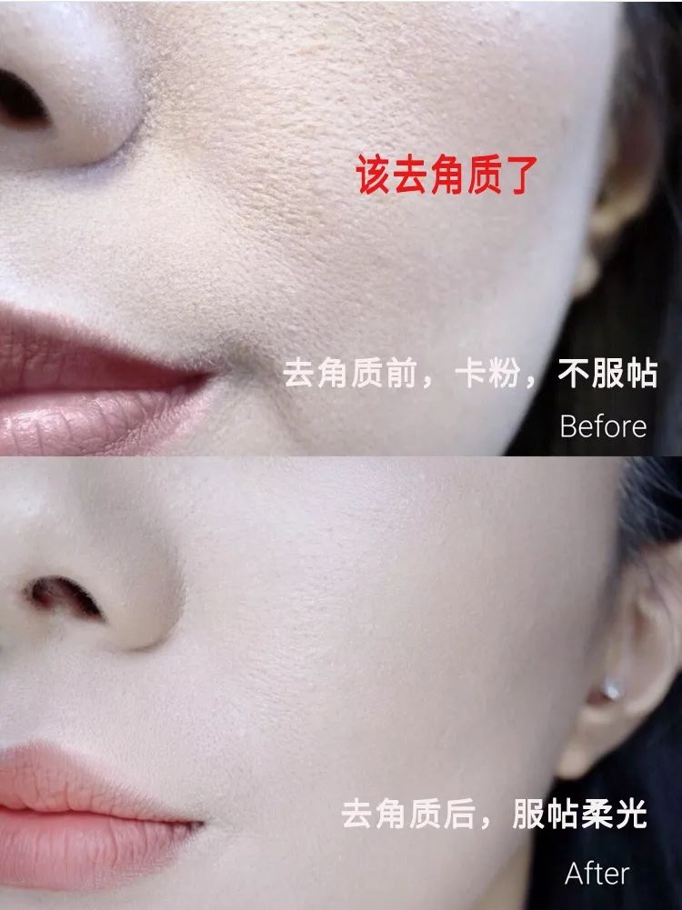 柔嫩抛光|脸上搓出3斤泥！难怪又黄又暗又黑头！10秒给脸蛋“剥壳”，厉害