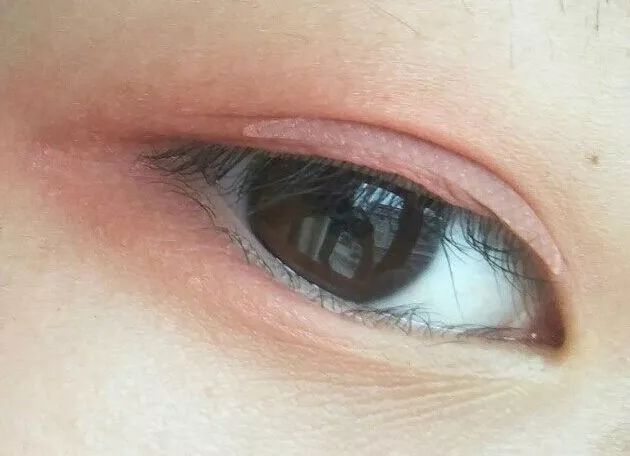 angelababy的双眼皮是什么情况,angelababy的脸整过容吗